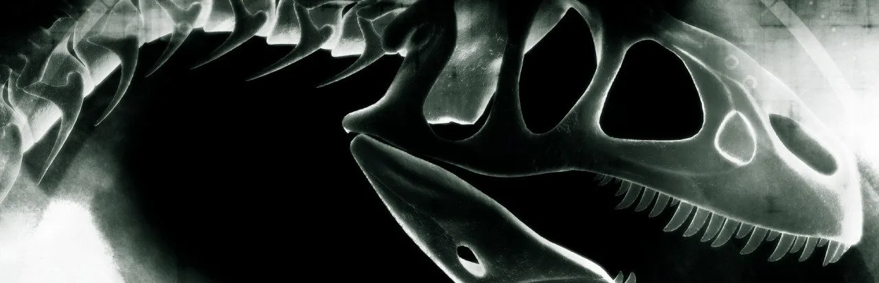 Compound Fracture