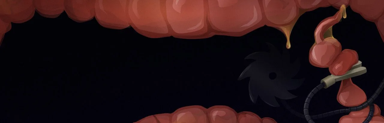 Revenge Of The Colon